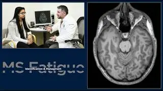 Clinical Approaches to Multiple Sclerosis Fatigue
