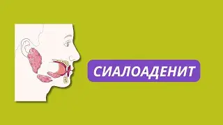 What is SIALADENITI? Causes and treatment.