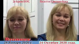Об изменениях внешности, при лечении Методом RANC.