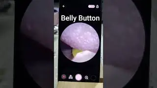 Belly Button 