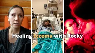 Our Baby’s Severe Eczema | What We Think Caused It (Story 1)