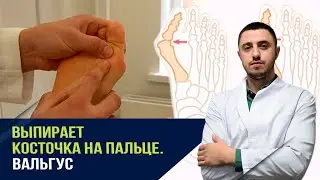 Болит спина, болят стопы, выпирает косточка на пальце. Гимнастика за 5 минут