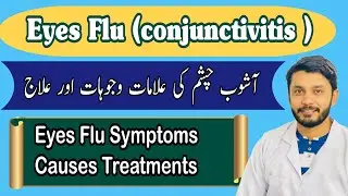 Eyes Flu |Conjunctivitis|pink eye