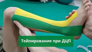 Тейпирование при ДЦП / Тейпування дітей при ДЦП - Наш Всесвіт Харьков