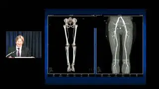 CT Protocols Design and Optimization: How We Do It - Part 2
