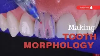 Anatomy of Maxillary Central Incisor | tooth Morphology | your dentist #anatomy #morphology