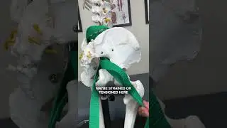 Sciatica's SECRET ROOT PROBLEM!