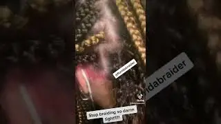 Someone braided her hair too tight!!! 
