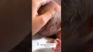 Bye flaky, scaly cradle cap scalp! Thank you Dr. Eddie's Happy Cappy.