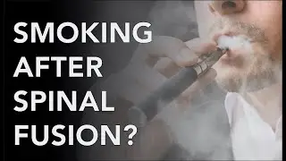 Fused EP 3: Smoking and Anti-Inflammatory use after a Spinal Fusion