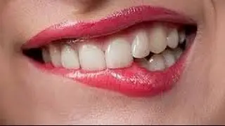 Xylit : Kan forebygge og standse caries og parodontose ( Tysk )