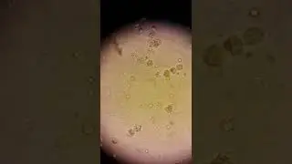 Gaita mikroskobisi lökosit & eritrosit