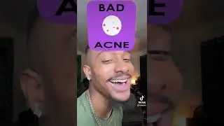 My biggest insecurity 🤣 #shorts #insecurity
