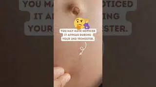 What is this DARK LINE😳on Pregnant Belly? 🧐