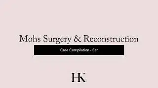 Before & After Cases Mohs Micrographic Reconstruction Surgery of Ear | Dr. Hooman Khorasani