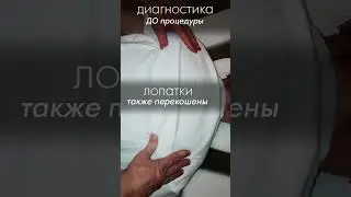 Сколиоз. Лопатки перекошены. Шея болит при повороте. Атлант разблокирован! АКУПРЕССУРА - Россия
