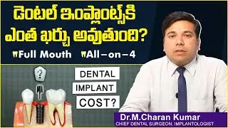 ఇంప్లాంట్స్ కి ఎంత ఖర్చు || Dental Implant Cost in Hyderabad || All-on-4 || Eledent Dental Hospitals