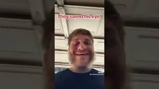Safety Glasses Saved His Eye!