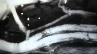 Строение и свойства нервной ткани 1978