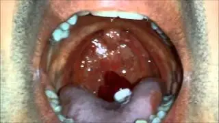 Me swallowing jelly sharks