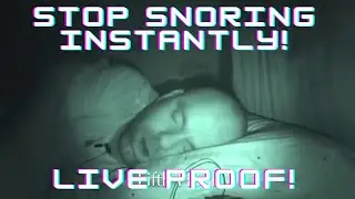 Anti Snoring Device | Stop Instantly! #shorts