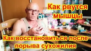 Как рвутся мышцы. Как восстановиться после порыва сухожилия