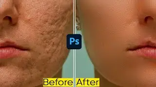 🔥Remove Scar Marks From Face in Photoshop Hindi✅