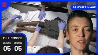 Orthopedic Surgery: A Life Changing Injury - 24 Hours In A&E - Medical Documentary