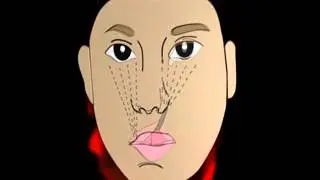 Embryology of the Head and Neck - Chapter 3: Congenital Defects
