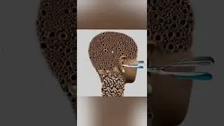 ASME DEEP EAR AND NECK CLEANING 