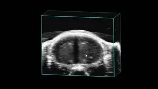 Vasculature in the Mouse Brain