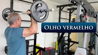 OLHO VERMELHO