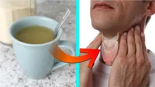 Thyroid का घरेलु उपाय | इन नुस्खो का इस्तेमाल थाइरोइड में करें | natural treatment for thyroid