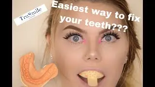 TruSmile Veneers Impressions Kit