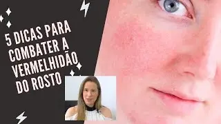 5 DICAS PARA COMBATER A VERMELHIDÃO DO ROSTO - Dra Cinthia Orasmo Dermatologista