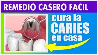 ¡Adiós Caries! Descubre este remedio efectivo