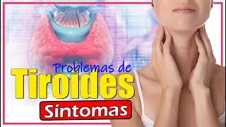 🔔 Señales y Síntomas de Que La TIROIDES NO FUNCIONA Bien | SALUDABLEMENTE TV