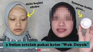 BEGINI JADINYA KALAU KAMU NUMBUHIN ALIS PAKAI KRIM WAK DOYOK :3
