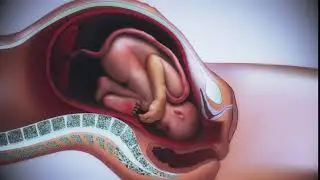 Animation of a baby being born. C4d and AE with puppet tool.