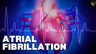 Understanding Atrial Fibrillation in 2024: Advances and Innovations