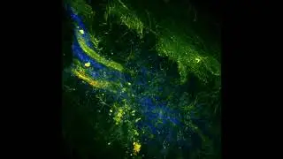 Multi-photon image of a mouse colon