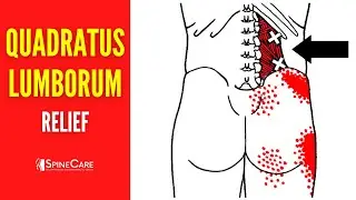 How to Fix Quadratus Lumborum Pain FOR GOOD
