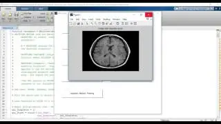 Brain MRI image noise removal matlab projects