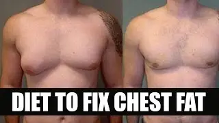 Diet for gyno/CHEST FAT