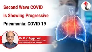 Second Wave Covid is Showing Progressive Pneumonia: COVID 19