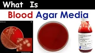 What is Blood Agar Media ? ( Complete & Clear Overview )