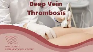 What is Deep Vein Thrombosis? What are the treatments?