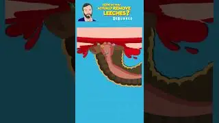 Should You Burn, Salt or Rip Leeches Off? How To Remove Leeches 
