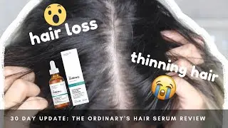 Hair Loss & Thinning Hair: Trying The Ordinary's Hair Serum