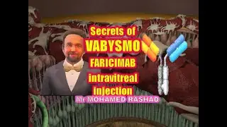 Secrets of VABYSMO (FARICIMAB) intravitreal injection for nAMD and DMO أحدث علاج لأمراض الشبكية